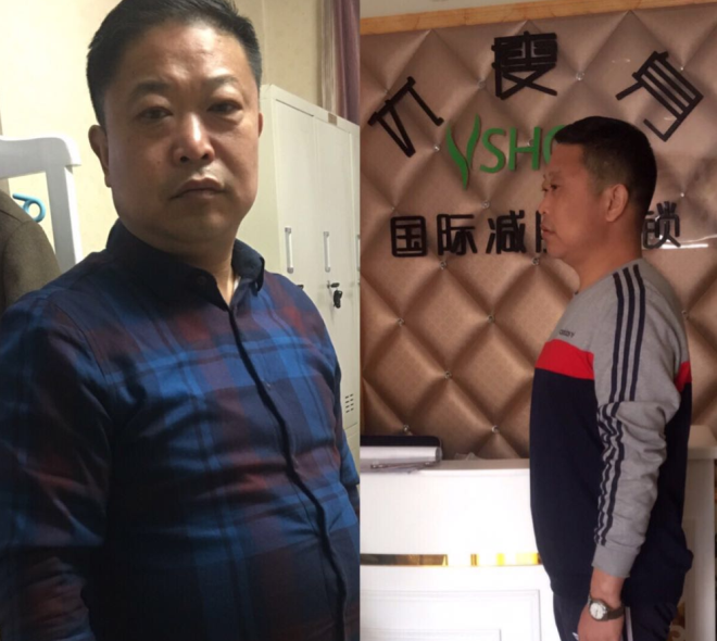 张玉松减肥案例